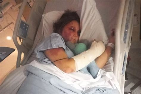 kirra hart news australia|Three teenage girls charged over alleged torture of another